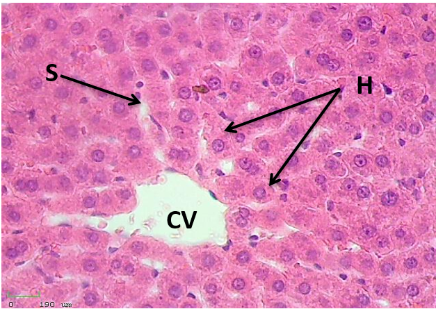 Liver of control group shows normal of central vein (CV), hepatocytes (HC) and sinusoids (S) H&E X400
